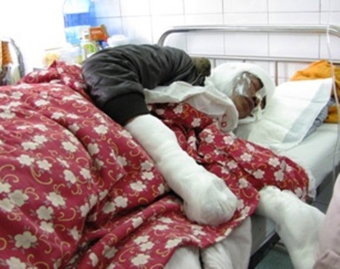 Hiện, anh Việt đang được cấp cứu trong bệnh viện Xanh - Pôn